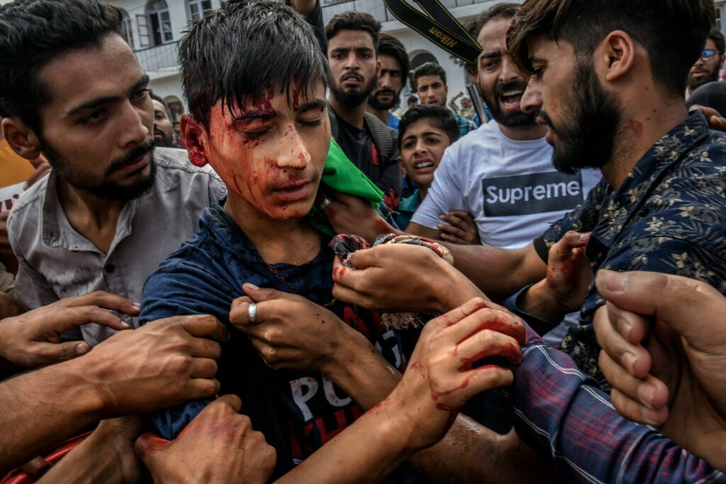 A 14-year-old boy injured by pellets shot by government forces during Friday protests in Srinagar on Sept. 13. Photography by Atul Loke for NY Times